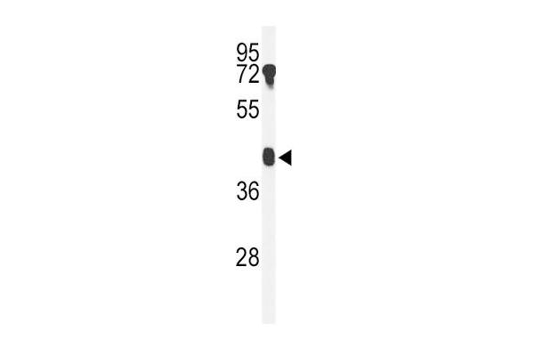 B4GALT2 antibody  (C-Term)