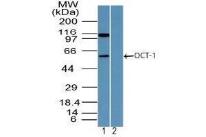 Image no. 2 for anti-POU Domain, Class 2, Transcription Factor 1 (POU2F1) (AA 1-50) antibody (ABIN960311)