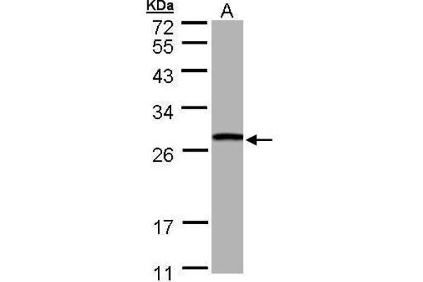 GSTT1 antibody