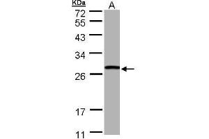 WB Image Sample (30 ug of whole cell lysate) A: Hep G2 , 10% SDS PAGE antibody diluted at 1:1000 (GSTT1 antibody)