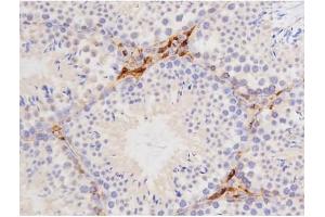 Immunohistochemistry (IHC) image for anti-Microtubule-Associated Protein tau (MAPT) (pThr212) antibody (ABIN6256508)