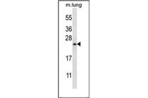 Western blot analysis of RHEBL1 (N-term) in Mouse lung tissue lysates (35ug/lane). (RHEBL1 antibody  (N-Term))