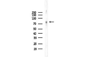 Western blot analysis of lysates from COLO205 cells(UV,30 min treatment), using Phospho-HSF1 (Ser303) Antibody at 1/1000 dilution.