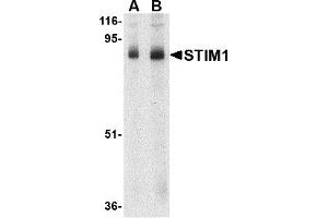 Western Blotting (WB) image for anti-Stromal Interaction Molecule 1 (STIM1) (C-Term) antibody (ABIN1030706) (STIM1 antibody  (C-Term))