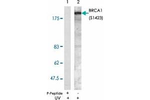Western blot analysis of extracts from K-562 cells treated with UV (20 min) using BRCA1 (phospho S1423) polyclonal antibody . (BRCA1 antibody  (pSer1423))
