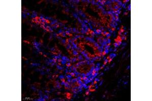 Immunofluorescence of paraffin embedded mouse rectum using WDR81 (ABIN7076221) at dilution of 1: 700 (400x lens) (WDR81 antibody)