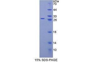 SDS-PAGE (SDS) image for Sperm Autoantigenic Protein 17 (SPA17) (AA 1-149) protein (His tag) (ABIN6238932) (SPA17 Protein (AA 1-149) (His tag))