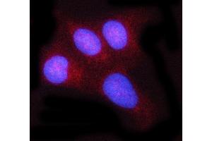 IF analysis of c-Rel/REL using anti-c-Rel/REL antibody (ABIN7599778). (c-Rel antibody  (AA 116-610))