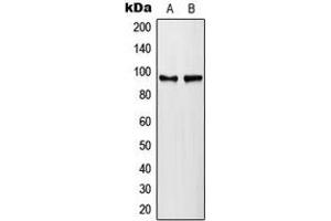 Western blot analysis of PLA2G4A (pS505) expression in HeLa lambda protein phosphatase-treated (A), NIH3T3 lambda protein phosphatase-treated (B) whole cell lysates. (PLA2G4A antibody  (pSer505))