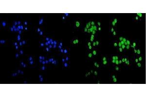IF analysis of CCDC36 using anti-CCDC36 antibody (ABIN6719645). (CCDC36 antibody  (AA 172-472))