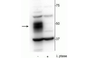 Western blot of OCIAML2 lysate showing specific immunolabeling of the ~51 kDa MEF2C phosphorylated at Ser222 in the first lane (-). (MEF2C antibody  (pSer222))