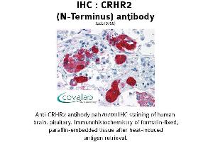 Image no. 1 for anti-Corticotropin Releasing Hormone Receptor 2 (CRHR2) (Extracellular Domain), (N-Term) antibody (ABIN1733313) (CRHR2 antibody  (Extracellular Domain, N-Term))
