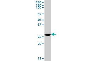 KHK MaxPab rabbit polyclonal antibody. (Ketohexokinase antibody  (AA 1-298))