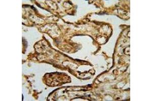 Immunohistochemistry analysis in human placenta tissue (Formalin-fixed, Paraffin-embedded) using MPP1 Antibody , followed by peroxidase conjugated secondary antibody and DAB staining. (MPP1 antibody  (Middle Region))