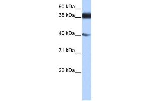 WB Suggested Anti-DKFZp686E2433 Antibody Titration:  0.