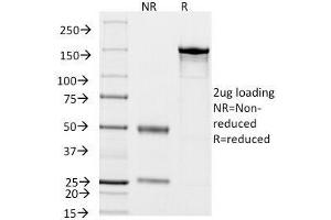 SDS-PAGE Analysis of Purified, BSA-Free Cytokeratin 18 Antibody (clone KRT18/834). (Cytokeratin 18 antibody)
