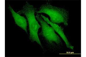 Immunofluorescence (IF) image for anti-Arrestin, beta 2 (ARRB2) (AA 300-409) antibody (ABIN559954)