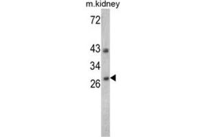 Western Blotting (WB) image for anti-Endonuclease G (ENDOG) antibody (ABIN3002690) (Endonuclease G antibody)