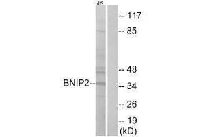Western blot analysis of extracts from Jurkat cells, using BNIP2 antibody. (BNIP2 antibody  (C-Term))