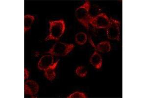 Immunofluorescence (IF) image for anti-Interleukin 23 (IL23) antibody (ABIN2665147) (IL23 antibody)