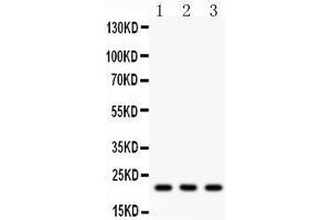 Western Blotting (WB) image for anti-Syndecan 4 (SDC4) (AA 172-198), (C-Term) antibody (ABIN3043323) (SDC4 antibody  (C-Term))