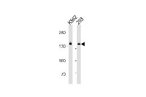 DHX9 Antibody (N-term) (ABIN1881260 and ABIN2843377) western blot analysis in K562 and 293 cell line lysates (35 μg/lane).