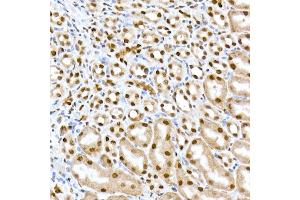 Immunohistochemistry of paraffin-embedded mouse kidney using RBM3 Rabbit mAb (ABIN7270084) at dilution of 1:25 (40x lens). (RBM3 antibody)