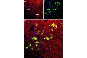 Expression of B2 bradykinin receptor in mouse spinal cord - Immunohistochemical staining of mouse spinal cord using Anti-B2 Bradykinin Receptor (BDKRB2) Antibody (ABIN7042968, ABIN7043942 and ABIN7043943). (BDKRB2 antibody  (C-Term, Intracellular))