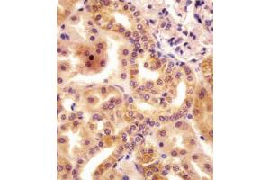 (ABIN655484 and ABIN2845005) staining RSBN1 in human kidney tissue sections by Immunohistochemistry (IHC-P - paraformaldehyde-fixed, paraffin-embedded sections). (RSBN1 antibody  (N-Term))