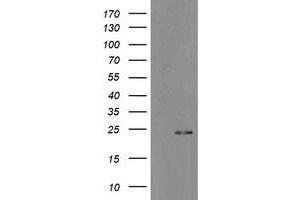 Image no. 2 for anti-Myosin Light Chain 7, Regulatory (MYL7) antibody (ABIN1499489) (MYL7 antibody)