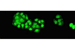 Immunofluorescent analysis of PC-3 cells using ABIN7151588 at dilution of 1:100 and Alexa Fluor 488-congugated AffiniPure Goat Anti-Rabbit IgG(H+L) (ELP6 antibody  (AA 95-195))