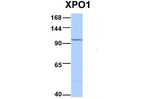 Host:  Rabbit  Target Name:  XPO1  Sample Type:  HepG2  Antibody Dilution:  1. (XPO1 antibody  (C-Term))
