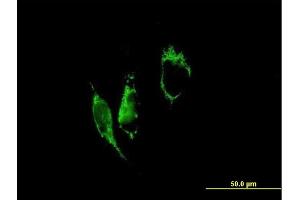 Immunofluorescence of purified MaxPab antibody to PYCR1 on HeLa cell. (PYCR1 antibody  (AA 1-319))