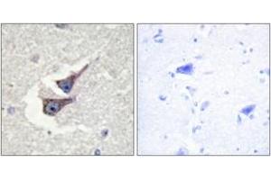 Immunohistochemistry analysis of paraffin-embedded human brain, using Catalase (Phospho-Tyr385) Antibody. (Catalase antibody  (pTyr385))
