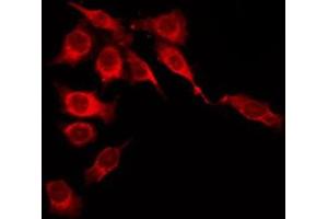 ABIN6276035 staining 293T by IF/ICC. (GPR35 antibody  (Internal Region))