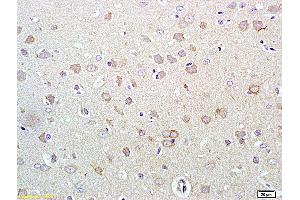 Formalin-fixed and paraffin embedded rat brain labeled with Rabbit Anti Phospho-HER3 (Tyr1289) Polyclonal Antibody, Unconjugated (ABIN747113) at 1:200 followed by conjugation to the secondary antibody and DAB staining (ERBB3 antibody  (pTyr1289))