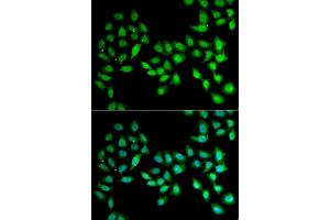 Immunofluorescence analysis of U2OS cell using UCN2 antibody. (Urocortin 2 antibody)