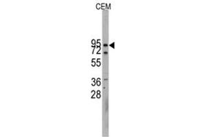Image no. 1 for anti-Cadherin 10, Type 2 (T2-Cadherin) (CDH10) (N-Term) antibody (ABIN357004) (CDH10 antibody  (N-Term))