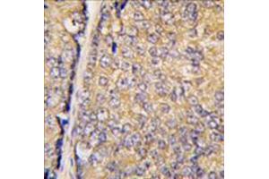 Image no. 1 for anti-Signal Transducing Adaptor Family Member 1 (STAP1) (N-Term) antibody (ABIN356991) (STAP1 antibody  (N-Term))