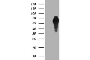 Western Blotting (WB) image for anti-alpha-Fetoprotein (AFP) (AA 19-397) antibody (ABIN2716008) (alpha Fetoprotein antibody  (AA 19-397))