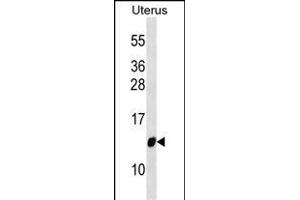 TIMM10 antibody  (AA 21-49)