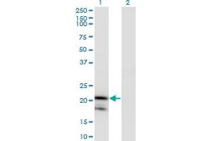 Western Blot analysis of IL1RN expression in transfected 293T cell line by IL1RN monoclonal antibody (M03), clone 1H5.