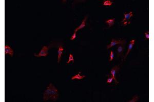 ABIN6266700 staining HeLa cells by IF/ICC. (MID1 antibody  (N-Term))
