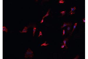 ABIN6266700 staining HeLa cells by IF/ICC.