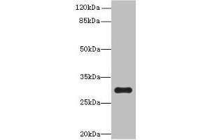 Western blot All lanes: OVOL1 antibody at 8 μg/mL + K562 whole cell lysate Secondary Goat polyclonal to rabbit IgG at 1/10000 dilution Predicted band size: 31 kDa Observed band size: 31 kDa