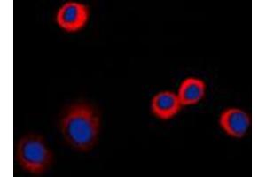 Immunofluorescent analysis of CD120b staining in PC12 cells. (TNFRSF1B antibody  (C-Term))