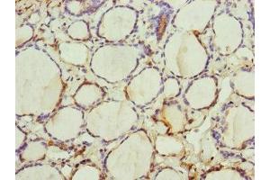 Immunohistochemistry of paraffin-embedded human thyroid tissue using ABIN7151252 at dilution of 1:100 (TRIM23 antibody  (AA 1-280))