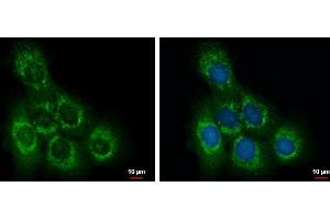 ICC/IF Image OCRL antibody detects OCRL protein at cytoplasm by immunofluorescent analysis. (OCRL antibody  (C-Term))