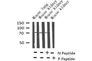 Western blot analysis of Phospho-Shc (Tyr349) expression in various lysates (SHC1 antibody  (pTyr349))