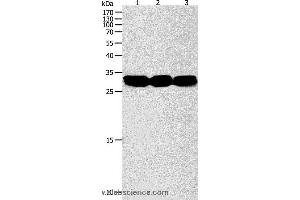 Western blot analysis of Mouse liver and kidney tissue, RAW264.